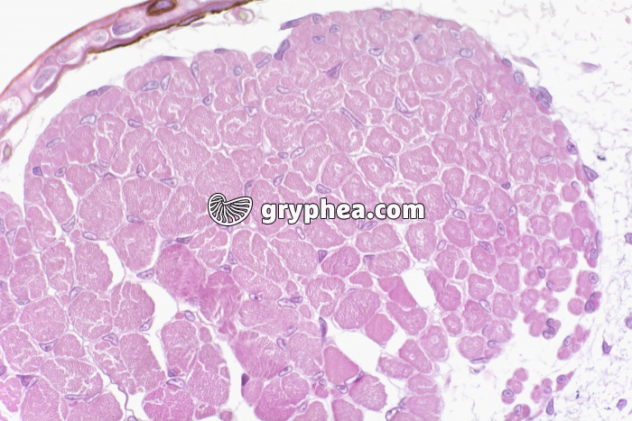 Tétard muscles en CT x100 - gryphea.com